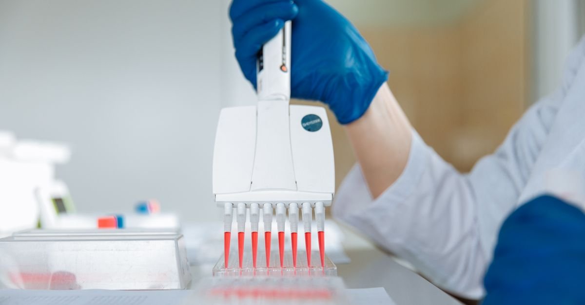 Pesquisador de luvas azuis usa pipeta multicanal em placa de testes dentro de laboratório