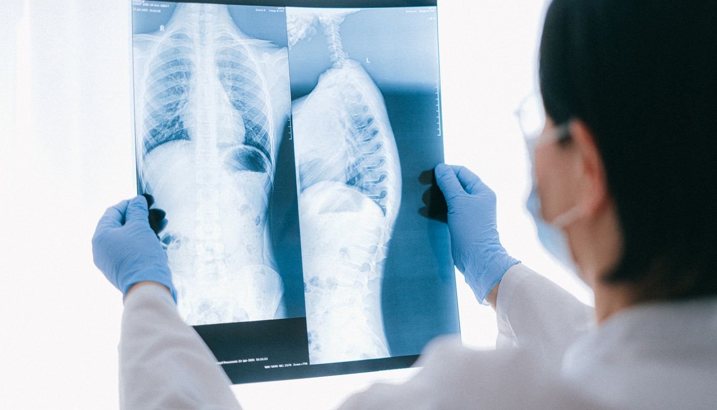 Profissional de saúde analisa radiografia de tórax contra a luz