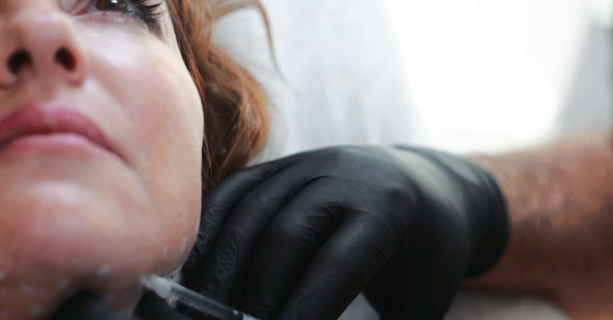 Profissional de luvas pretas aplica injeção no rosto de uma mulher em clínica de estética