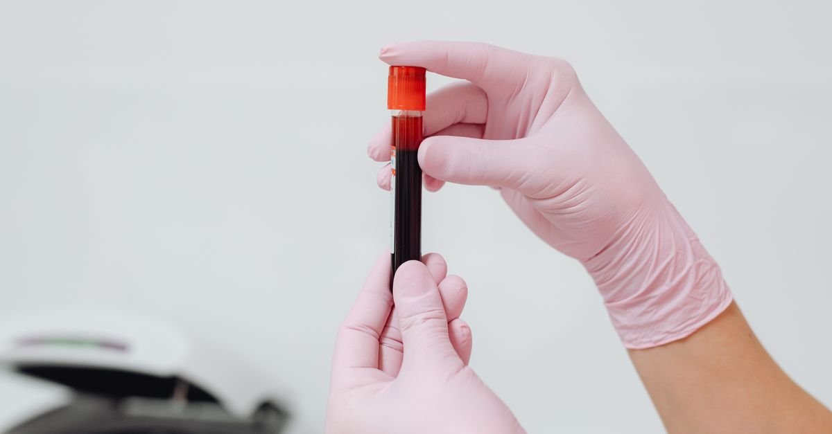Profissional de luvas segura tubo de coleta com amostra de sangue em laboratório