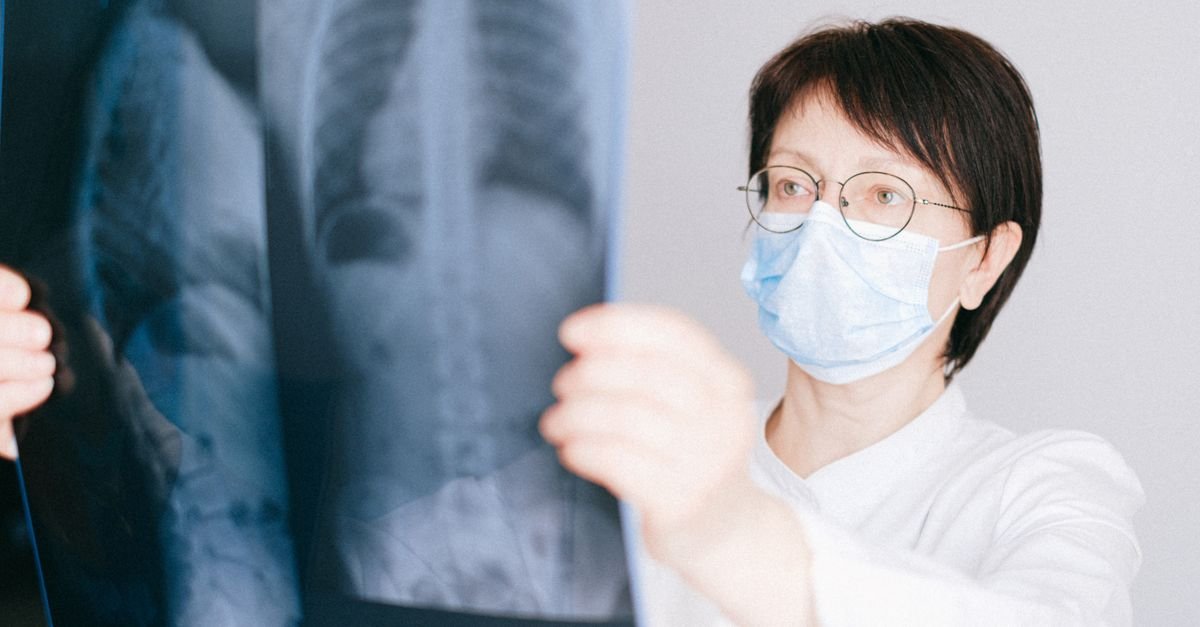 Profissional de saúde analisa radiografia de tórax contra a luz