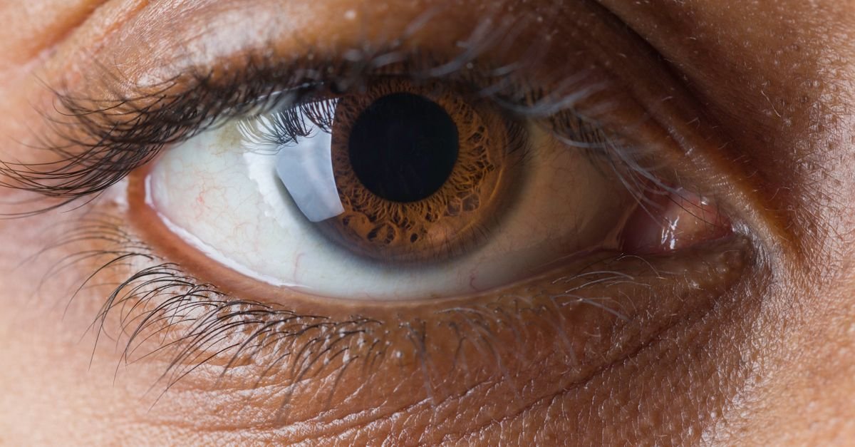 Closeup de olho humano adulto com vasos avermelhados na esclera e íris castanha
