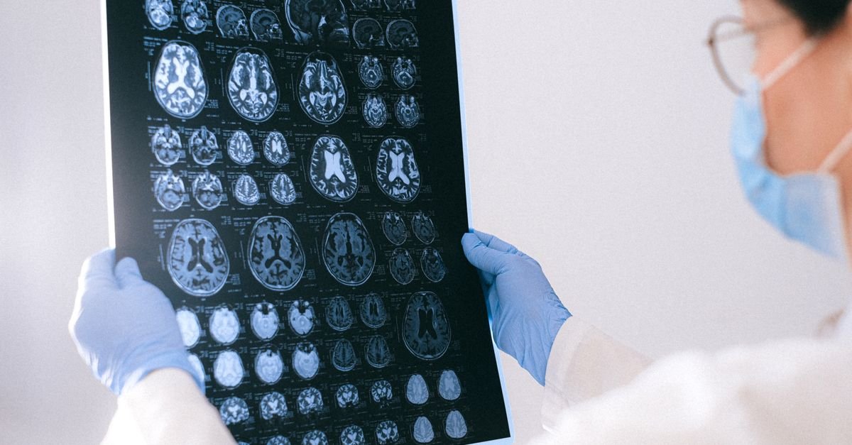 Profissional de saúde examina imagens de ressonância magnética do cérebro
