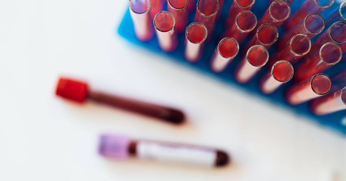 Tubos de coleta de sangue organizados em suporte de laboratório