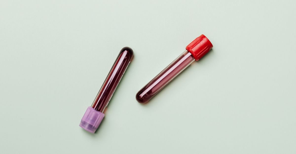 Dois tubos de coleta de sangue sobre fundo claro