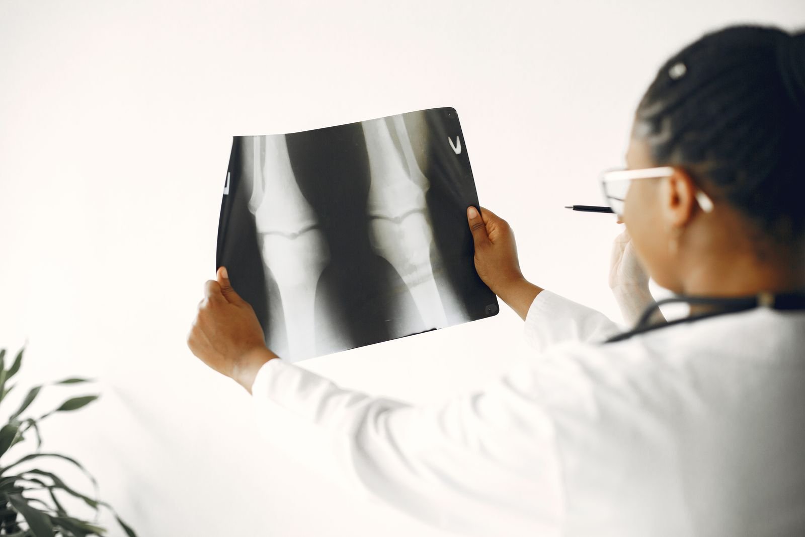 Médica analisa radiografia de joelhos, imagem ilustrativa sobre cirurgias de ortopedia